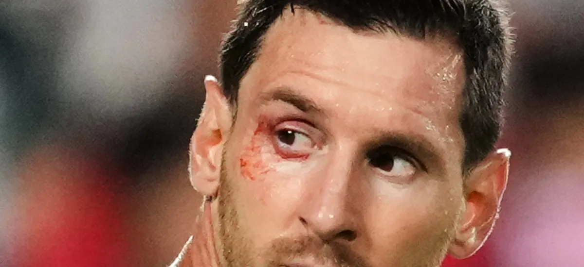 El corte en el ojo que sufrió Lionel Messi durante el duelo entre Argentina y Suiza del Mundial 2026