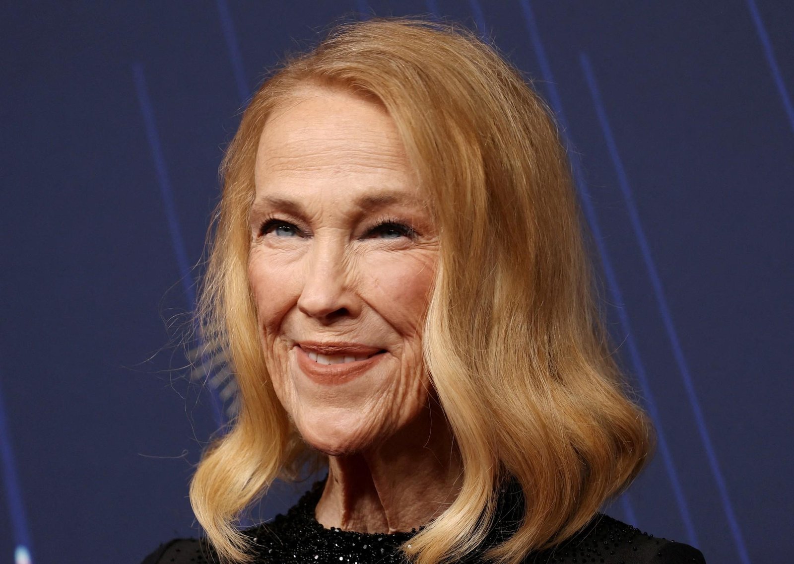 "Situs inversus", la rara enfermedad que sufría Catherine O’Hara, la mamá de Mi pobre Angelito: cómo detectarla