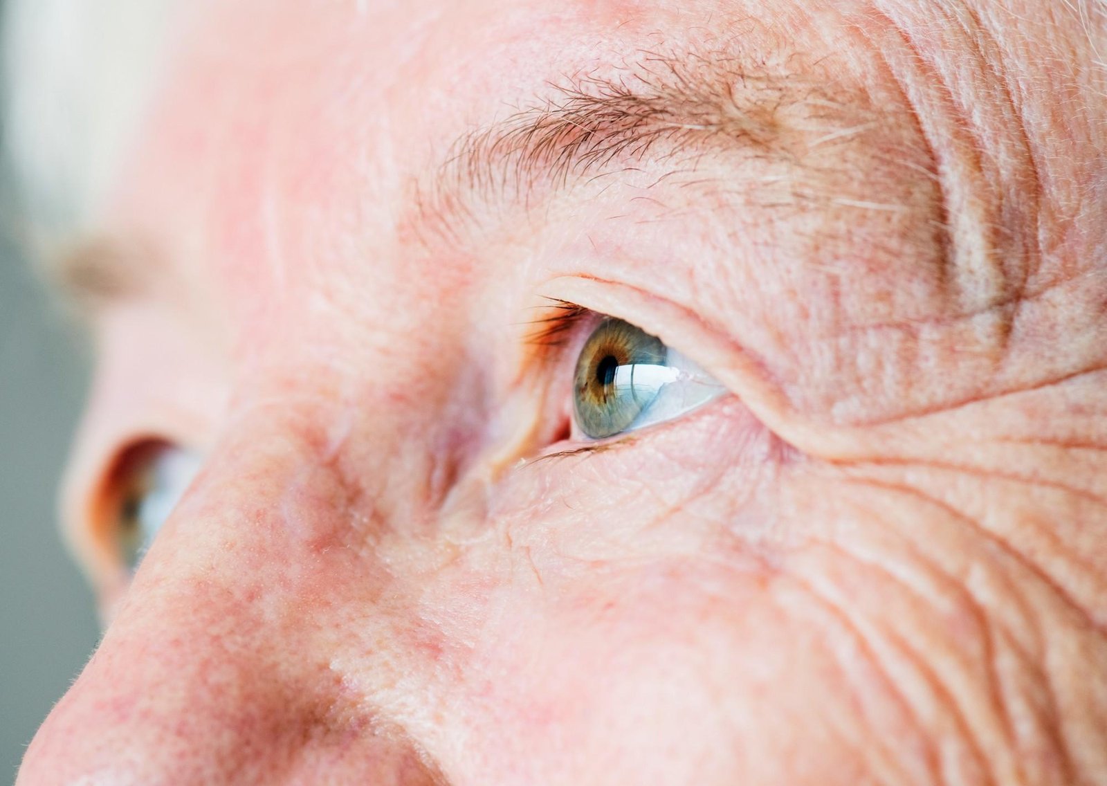 Colesterol alto: las señales que pueden verse en los ojos