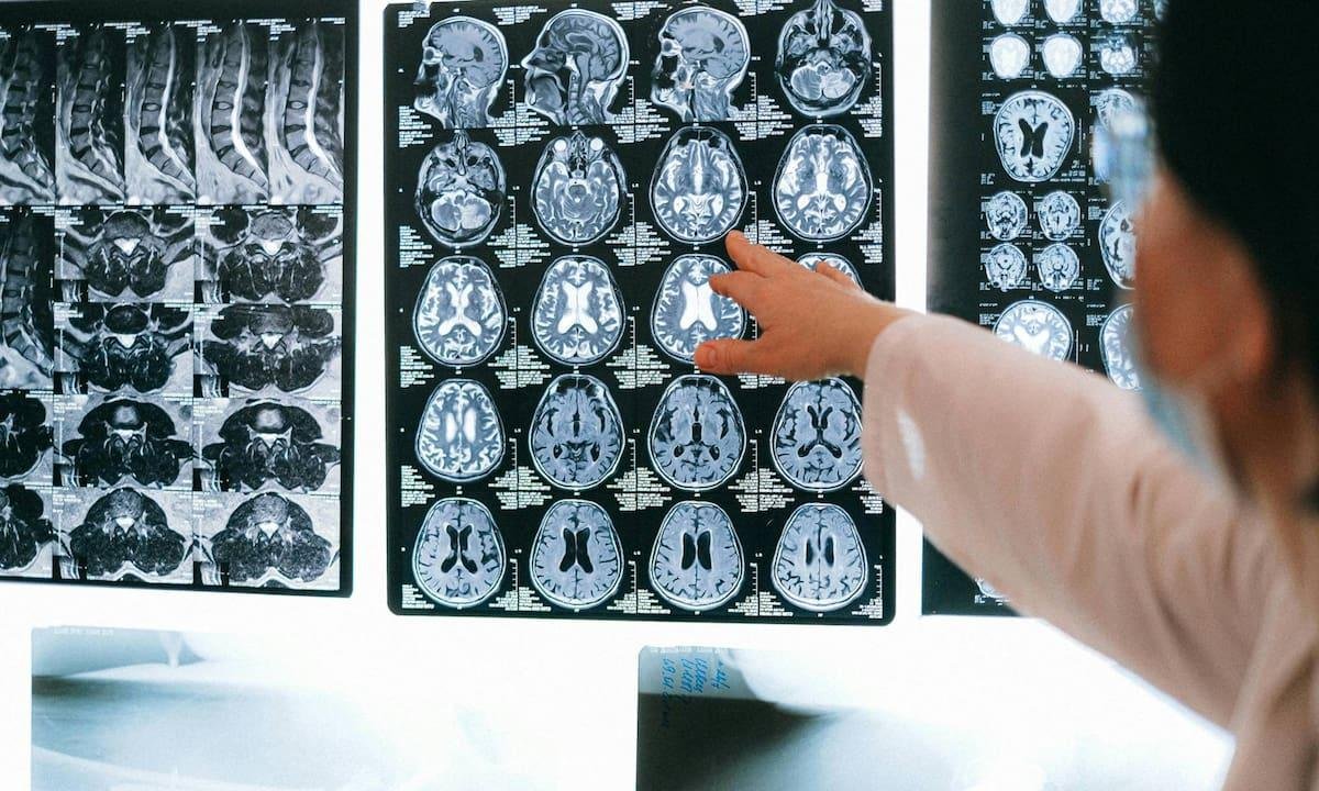 Científicos de la Universidad de Stony Brook revelan la edad en la que la función cerebral empieza a disminuir