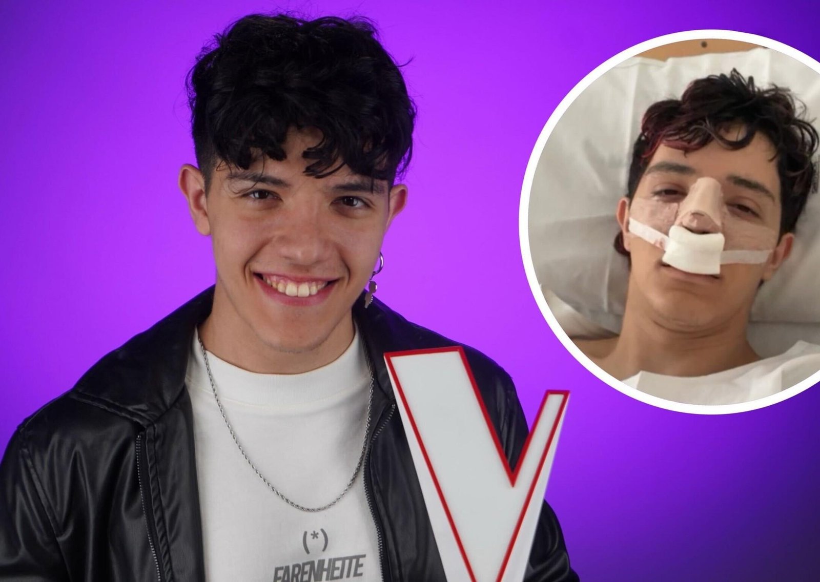 Nicolás Behringer, el campeón de La Voz Argentina, se operó la nariz: las fotos del antes y el después