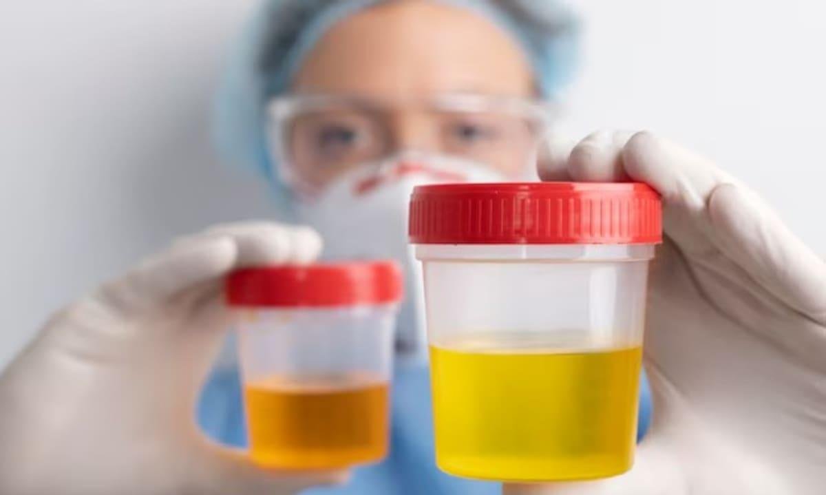 Calor en aumento: el dato que puede revelarnos la orina y que debemos atender cuanto antes en verano