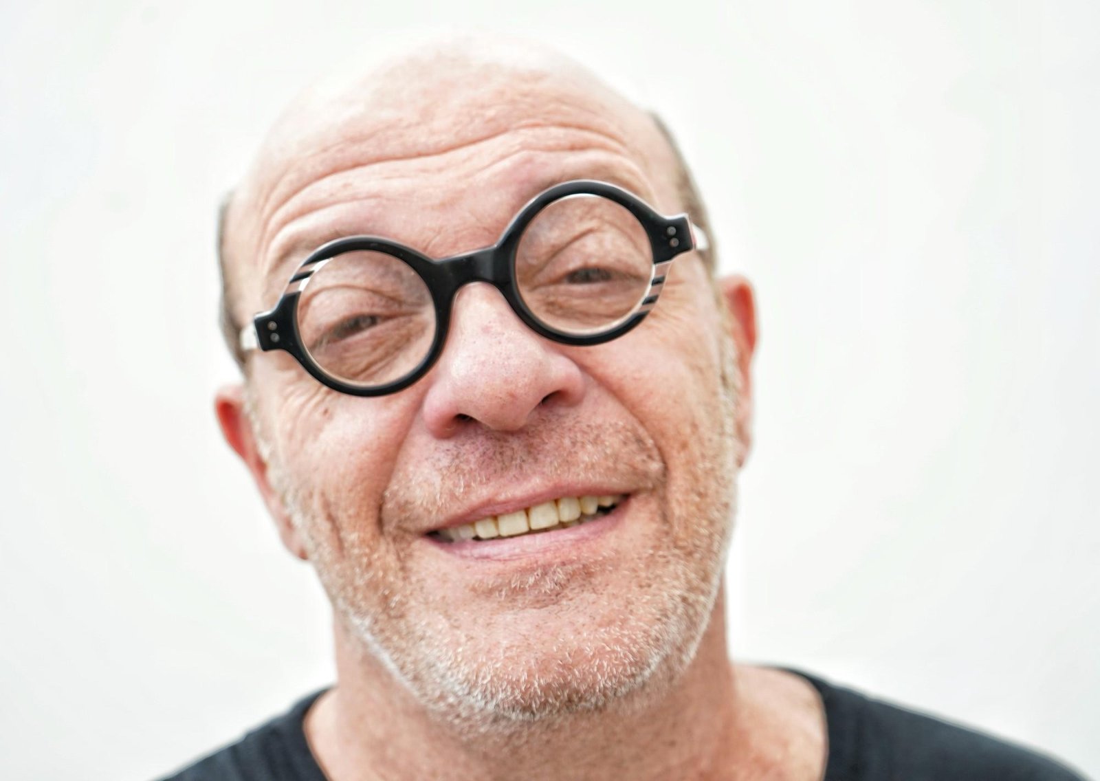 Campi reveló que fabricó una prótesis de nariz para un hombre con una grave enfermedad: su emocionante relato