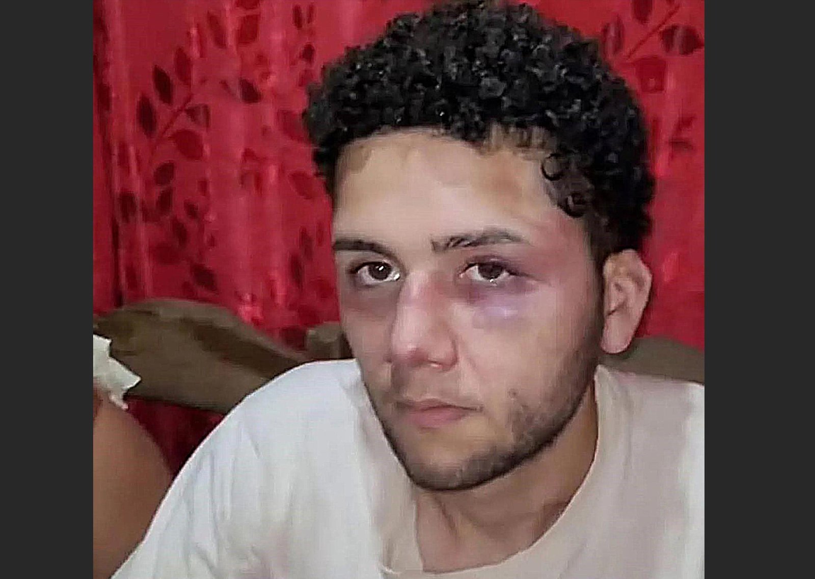 El accidente laboral que se convirtió en un calvario: sus empleadores lo atacaron brutalmente para no pagarle