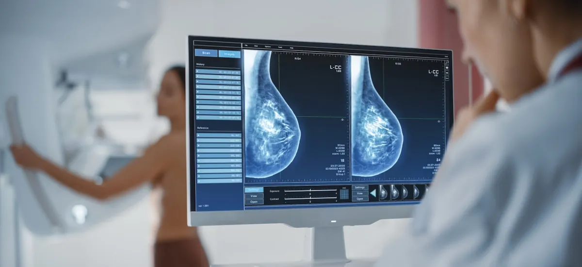 Estos son los cuatro estudios que debe hacerse cualquier mujer después de los 40 años, según un doctor