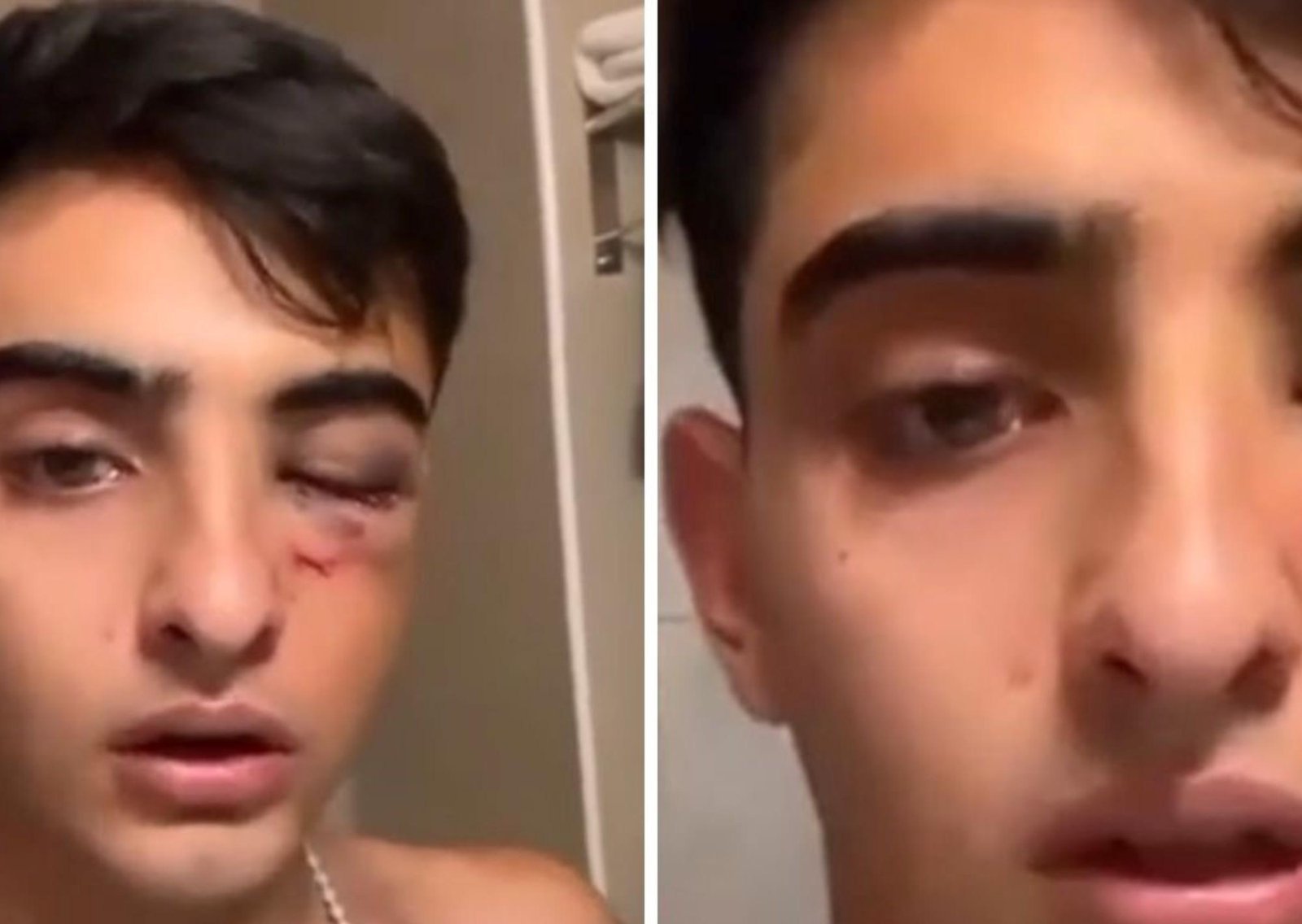 Salvaje ataque en patota de un grupo de rugbiers a un joven de 19 años a la salida de un boliche en Tucumán: "No me puedo mover"